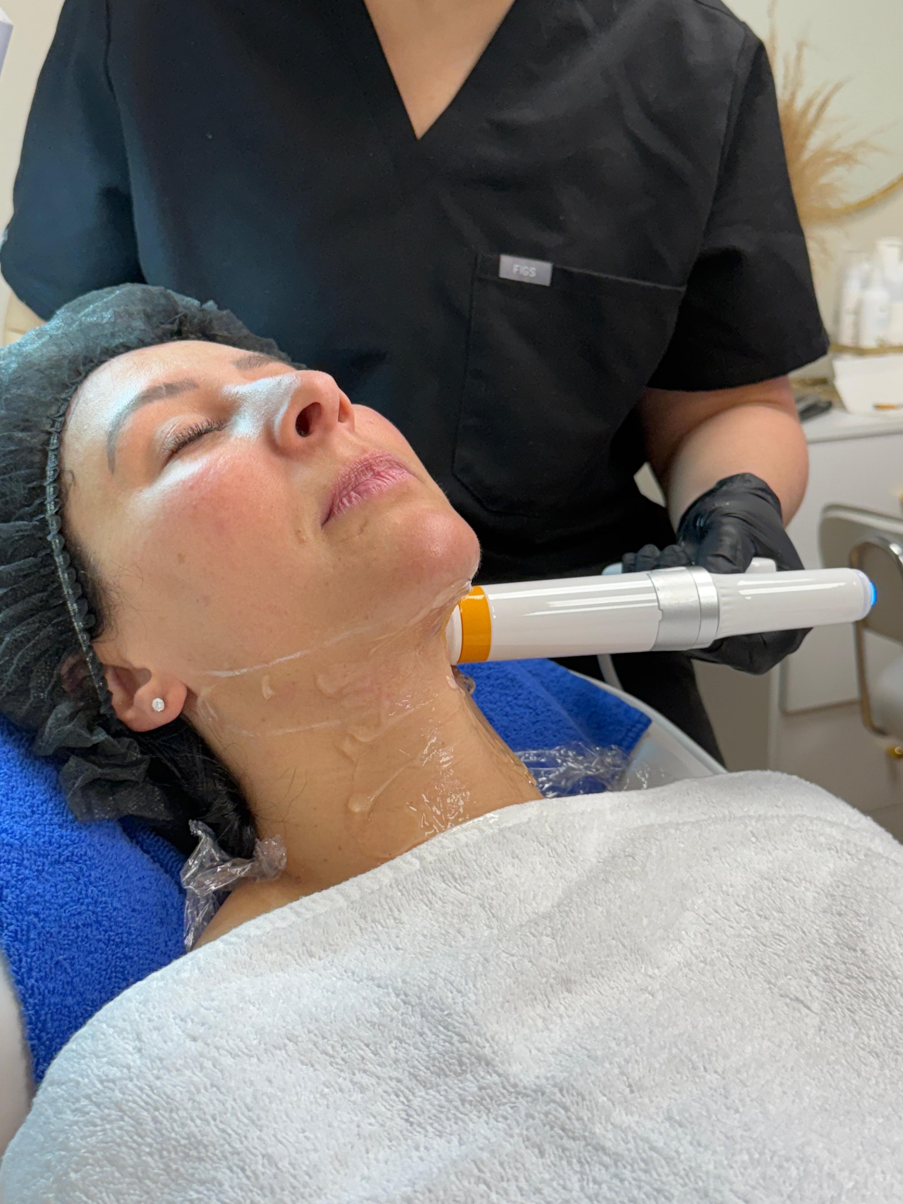 Ultraformer - Double Chin